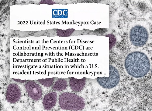 virus đậu mùa khỉ là họ hàng với virus đậu mùa thông thường